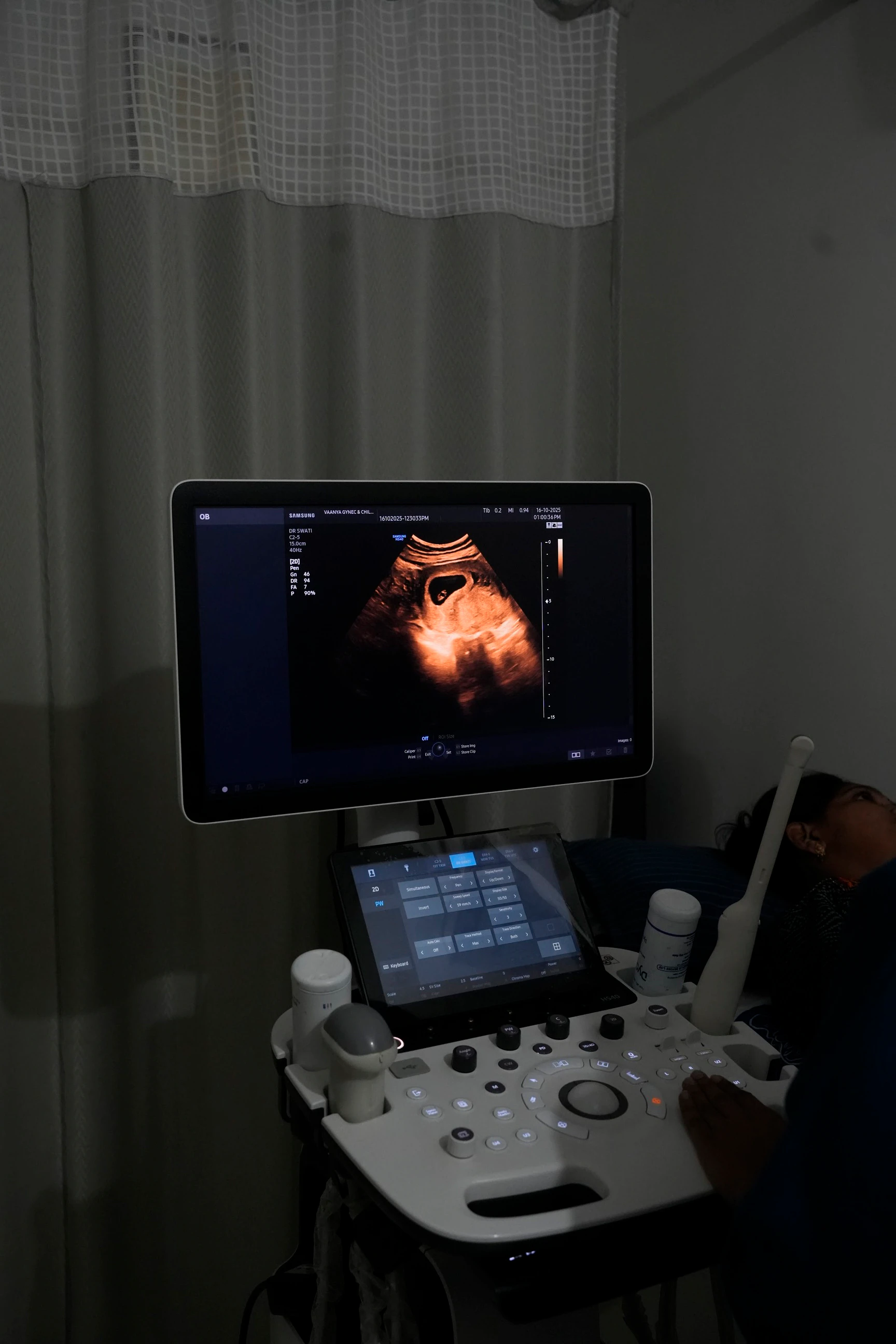 Ultrasound scan at Vaanya Hospital